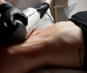 Endospheres Therapy treatment at MED YU MED Dubai
