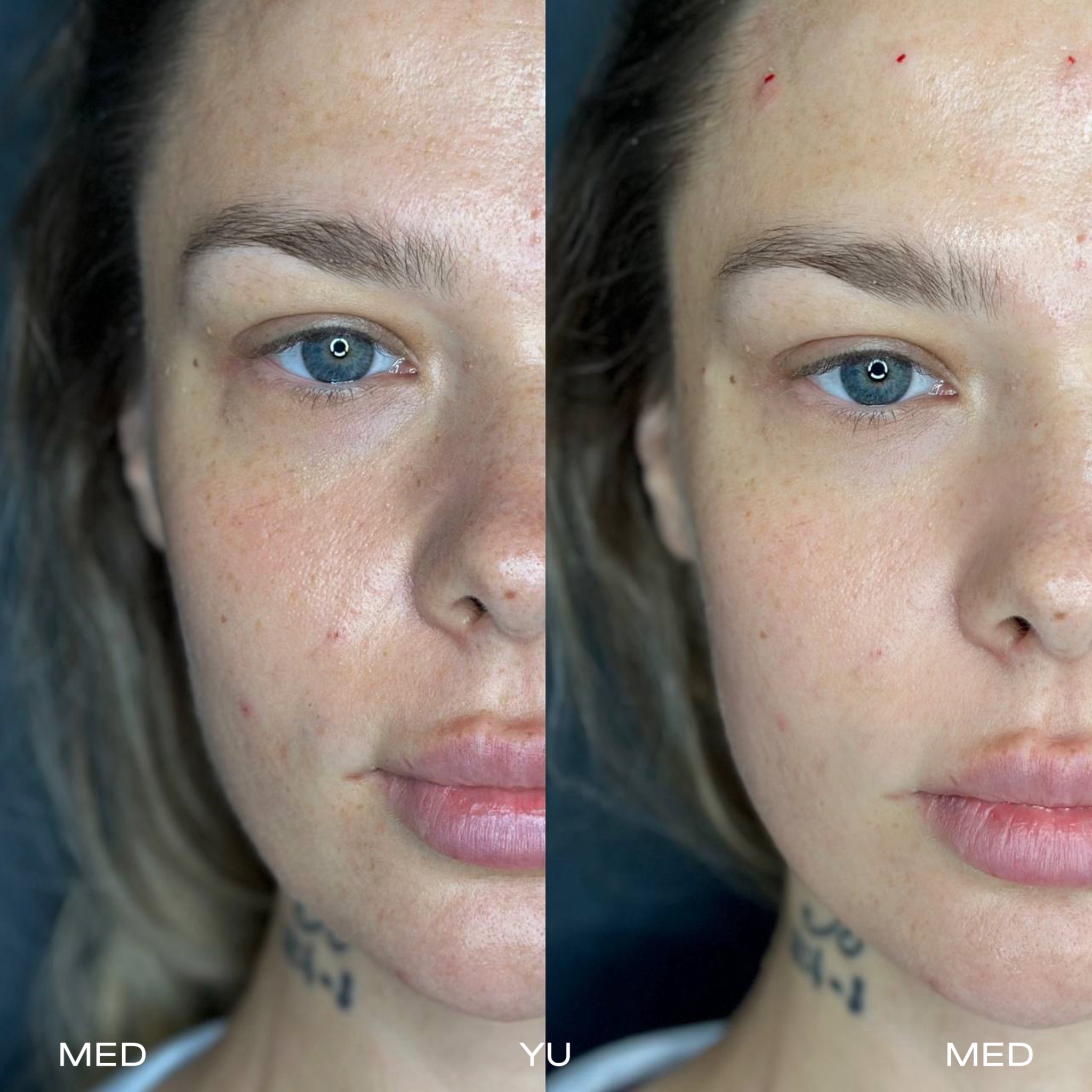 Before and after at MED YU MED Dubai: full face