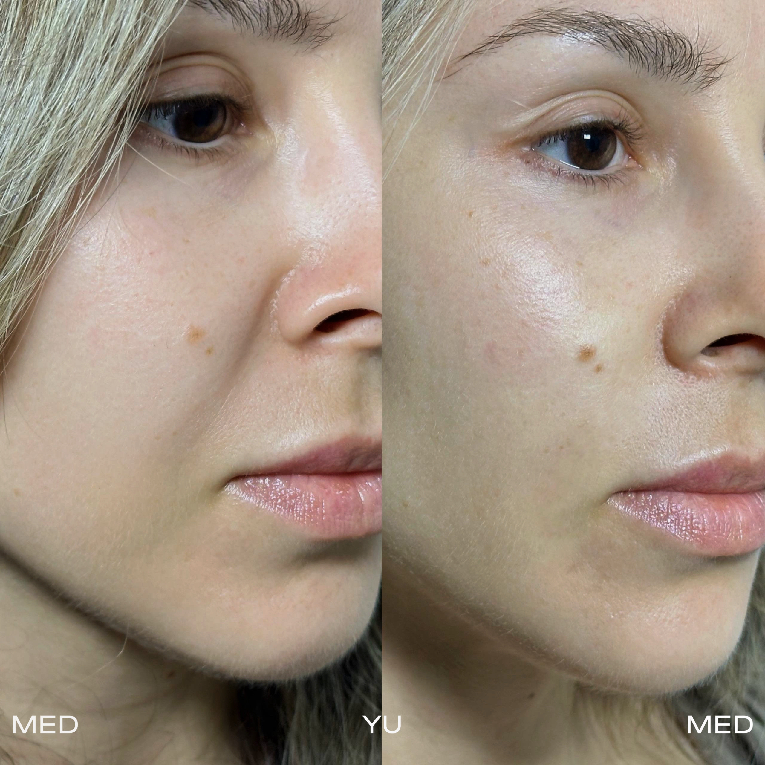 Before and after at MED YU MED Dubai: full face