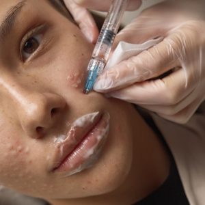 5 Facts About PDRN You Should Know Before Your Treatment at MED YU MED Dubai