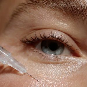 Biorevitalization Before or After a Vacation: How to Properly Prepare Your Skin for the Sun and Rescue It Afte at MED YU MED Dubai