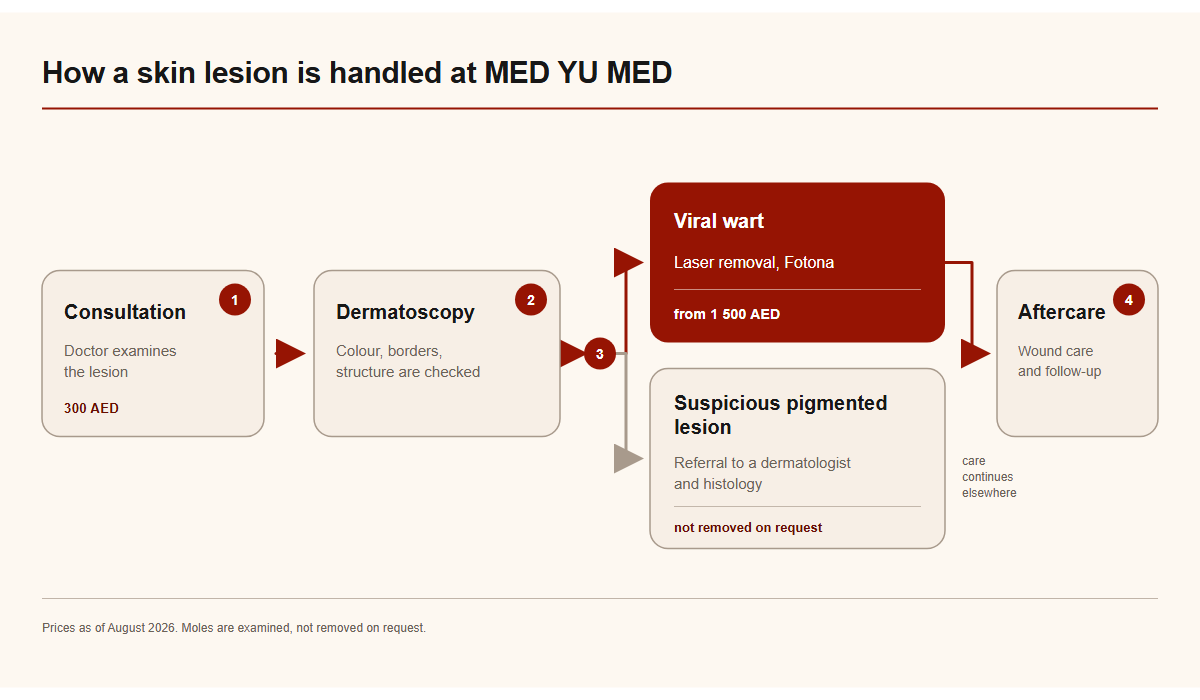 Patient route at MED YU MED: consultation 300 AED, dermatoscopy, laser removal of a viral wart or referral for a suspicious pigmented lesion